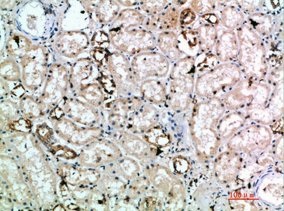 a11884 1 klrc4 primary antibodyes ihc testing 1