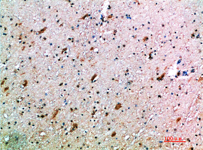 a11884 1 klrc4 primary antibodyes ihc testing 2