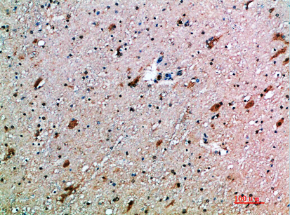 a11884 1 klrc4 primary antibodyes ihc testing 3
