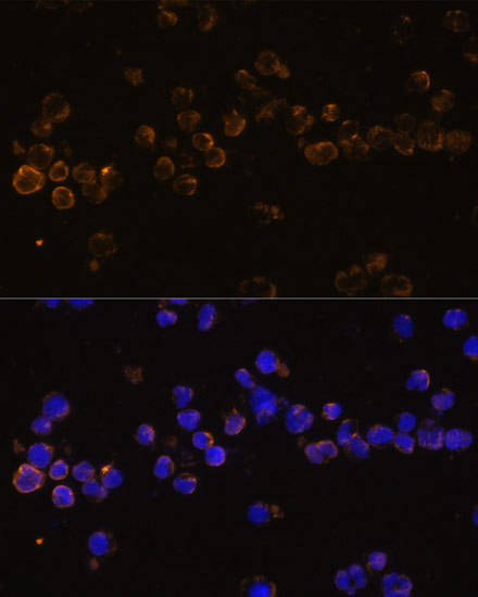 Immunofluorescence analysis of Jurkat cells using KLRC4 Polyclonal Antibody  at dilution of 1:100 