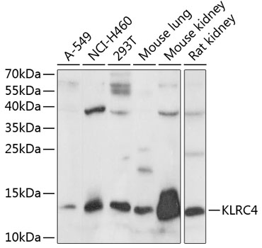 Western blot analysis of extracts of various cell lines, using KLRC4 antibody  at 1:1000 dilution