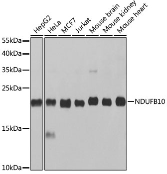 a11886 2 ndufb10 primary antiboties wb testing 1