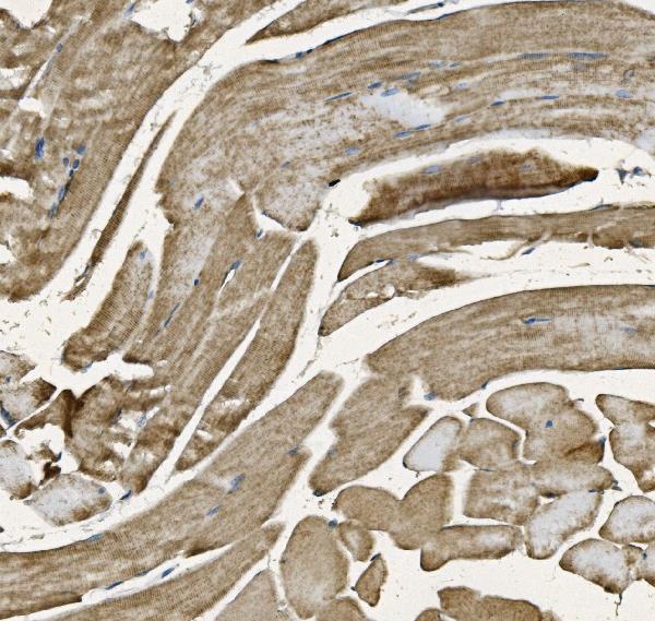 Figure 2. IHC analysis of NDUFB10 using anti-NDUFB10 antibody (A11886-3). NDUFB10 was detected in paraffin-embedded section of mouse skeletal muscle tissue. Heat mediated antigen retrieval was performed in EDTA buffer (pH8.0, epitope retrieval solution). The tissue section was blocked with 10% goat serum. The tissue section was then incubated with 2microg/ml rabbit anti-NDUFB10 Antibody (A11886-3) overnight at 4°C. Biotinylated goat anti-rabbit IgG was used as secondary antibody and incubated for 30 minutes at 37°C. The tissue section was developed using Strepavidin-Biotin-Complex (SABC) (Catalog # SA1022) with DAB as the chromogen.