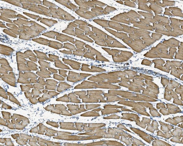 Figure 3. IHC analysis of NDUFB10 using anti-NDUFB10 antibody (A11886-3). NDUFB10 was detected in paraffin-embedded section of rat skeletal muscle tissue. Heat mediated antigen retrieval was performed in EDTA buffer (pH8.0, epitope retrieval solution). The tissue section was blocked with 10% goat serum. The tissue section was then incubated with 2microg/ml rabbit anti-NDUFB10 Antibody (A11886-3) overnight at 4°C. Biotinylated goat anti-rabbit IgG was used as secondary antibody and incubated for 30 minutes at 37°C. The tissue section was developed using Strepavidin-Biotin-Complex (SABC) (Catalog # SA1022) with DAB as the chromogen.