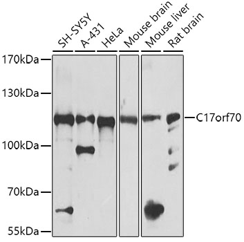 Western blot analysis of extracts of various cell lines, using C17orf70 antibody  at 1:1000 dilution