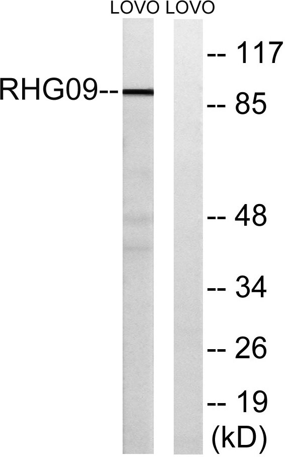 Western blot analysis of lysates from LOVO cells, using RHG9 Antibody