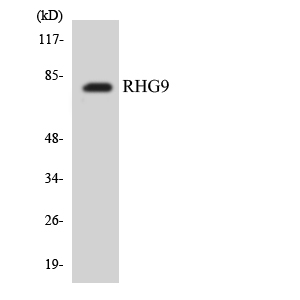 Western blot analysis of the lysates from COLO205 cells using RHG9 antibody