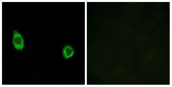 a11901 chst9 primary antibodies if testing 1