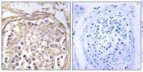a11901 chst9 primary antibodies ihc testing 2