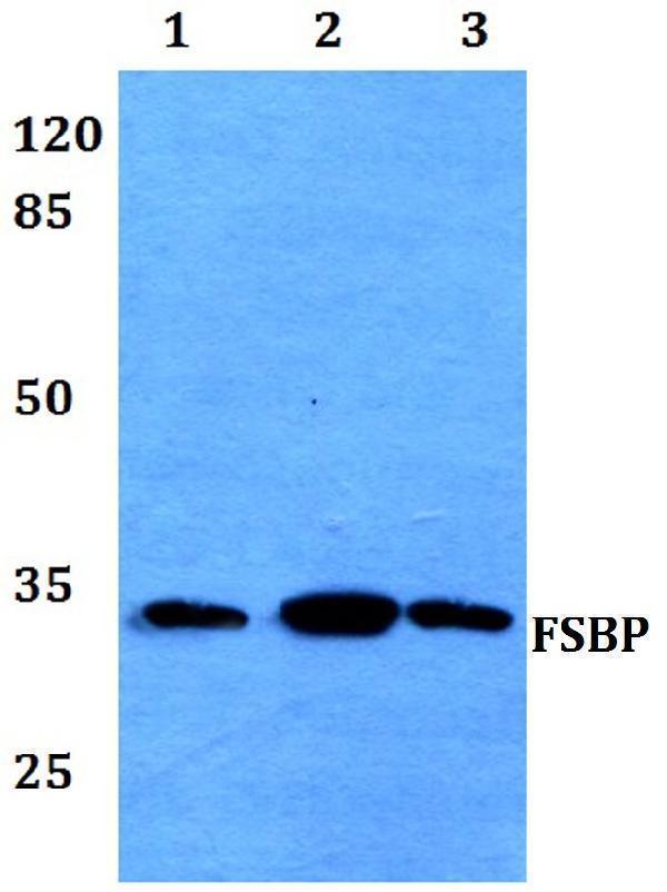 Western blot (WB) analysis of FSBP polyclonal antibody at 1:500 dilution
Lane1:HEK293T whole cell lysate
Lane2:NIH-3T3 whole cell lysate
Lane3:Mouse stomach tissue lysate