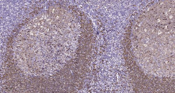 a11908 1 polr1b primary antibodies ihc testing 1