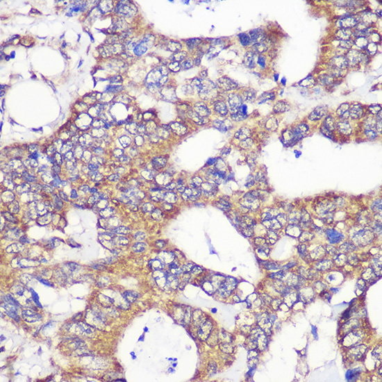 a11918 1 tubgcp6 primary antiboties ihc testing 2