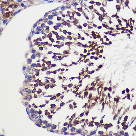 a11918 1 tubgcp6 primary antiboties ihc testing 3