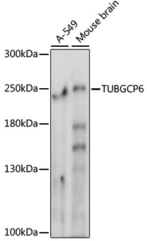 a11918 1 tubgcp6 primary antiboties wb testing 1