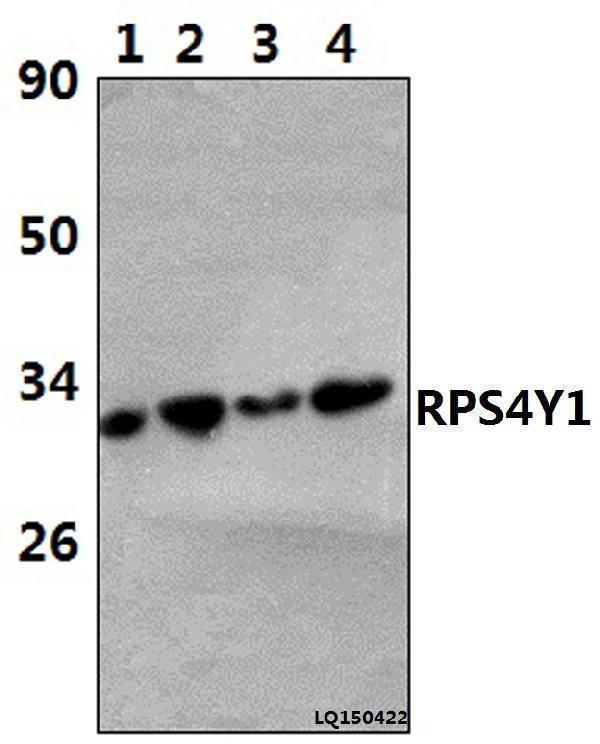 Western blot (WB) analysis of RPS4Y1 (K254) polyclonal antibody at 1:1000 dilution   Lane1:HELA whole cell lysate(42ug)  Lane2:HEK293T whole cell lysate(37ug)  Lane3:LO2 whole cell lysate(38ug)  Lane4:RAW264