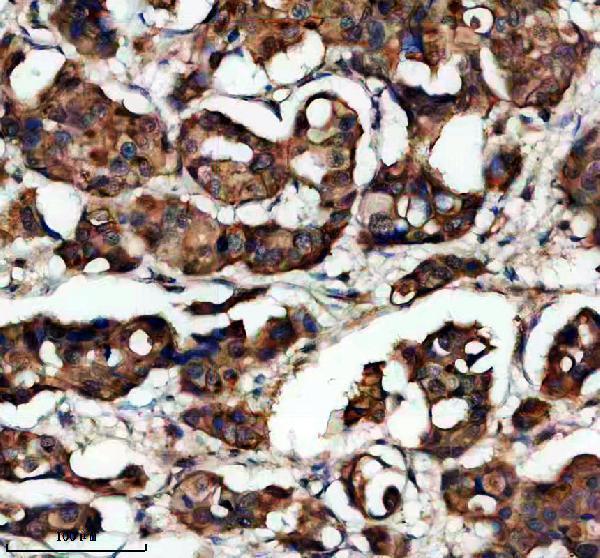 IHC analysis of EFHD1 using anti-EFHD1 antibody (A11920-2)