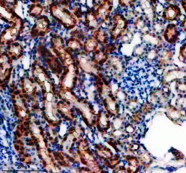 IHC analysis of EFHD1 using anti-EFHD1 antibody (A11920-2)
