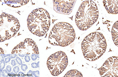 a11920 efhd1 primary antibodies ihc testing 4