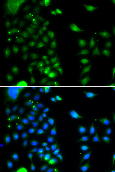 Immunofluorescence analysis of MCF7 cell using UBE2J2 antibody