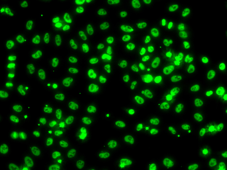 a11926 csrnp1 primary antiboties if testing 3