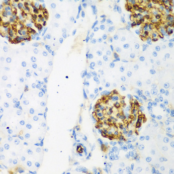 a11926 csrnp1 primary antiboties ihc testing 1