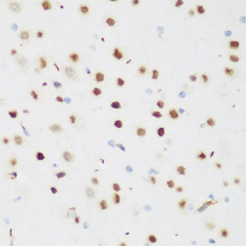 a11926 csrnp1 primary antiboties ihc testing 2