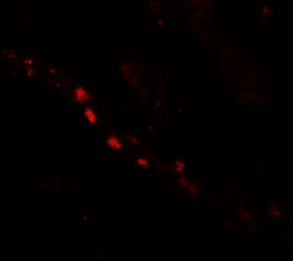 a11929 1 ptchd2 primary antibodies if testing 3