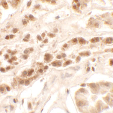 a11929 1 ptchd2 primary antibodies ihc testing 2