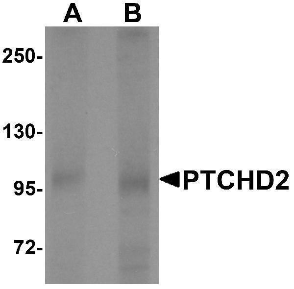 a11929 1 ptchd2 primary antibodies wb testing 1