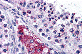 a11929 ptchd2 primary antibodies ihc testing 1