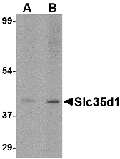 a11935 1 slc35d1 primary antibodies wb testing 1