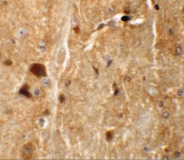 a11938 tmem192 primary antibodies ihc testing 2