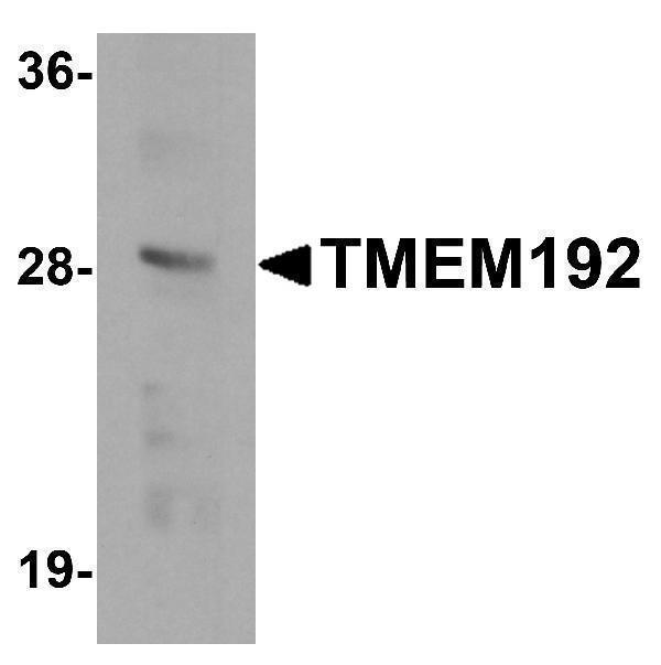 a11938 tmem192 primary antibodies wb testing 1