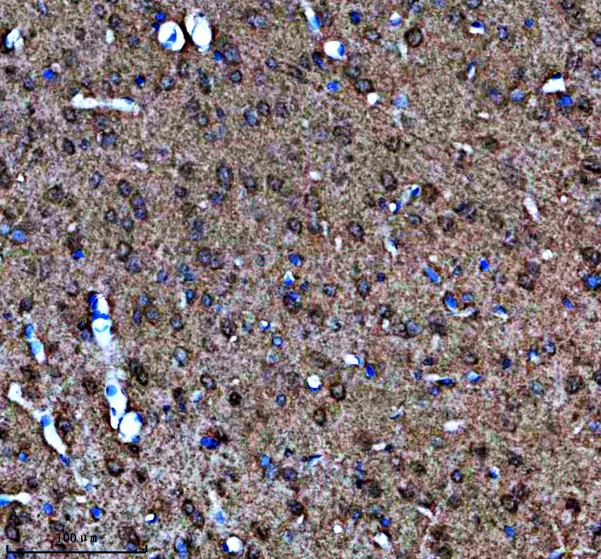 a11947 1 kcnh3 primary antibodies ihc testing 1