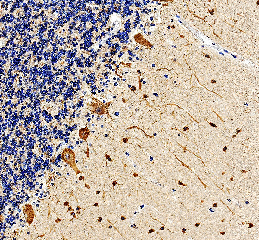 a11947 1 kcnh3 primary antibodies ihc testing 2