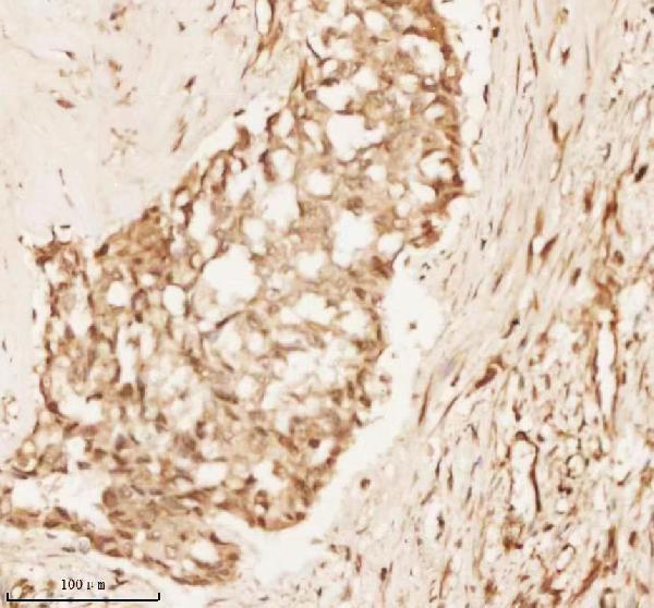 a11950 1 nup43 primary antibodies ihc testing 11