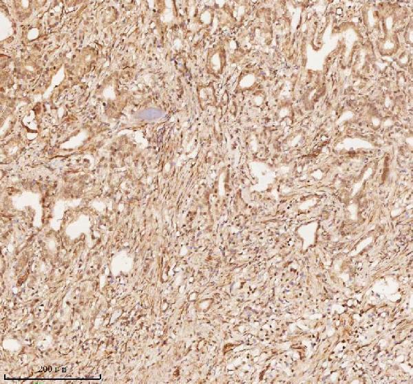 a11950 1 nup43 primary antibodies ihc testing 14