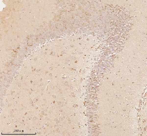 a11950 1 nup43 primary antibodies ihc testing 18