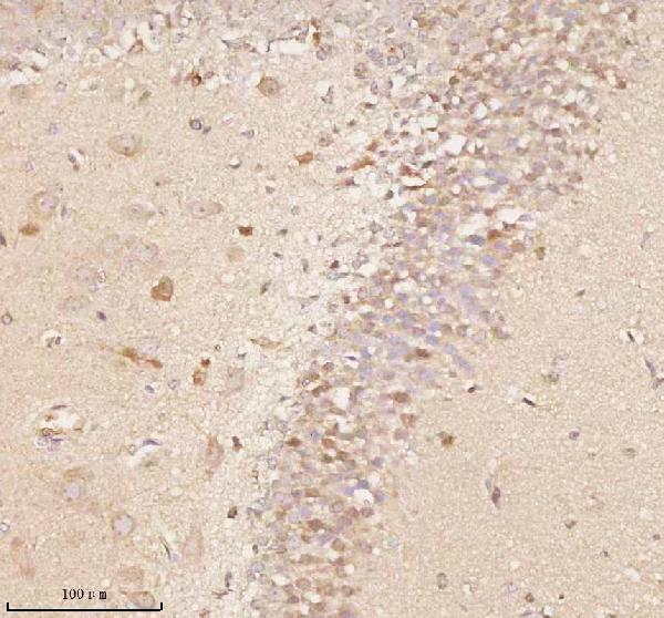 a11950 1 nup43 primary antibodies ihc testing 19