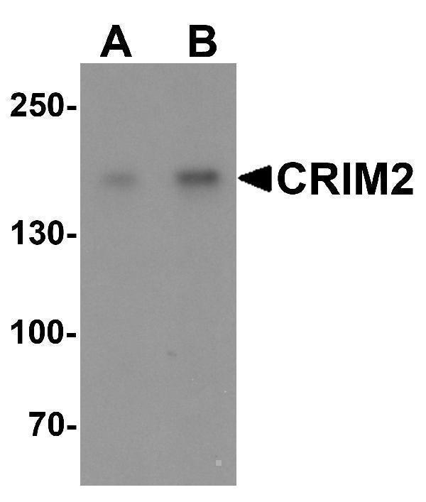 a11951 kcp primary antibodies wb testing 1