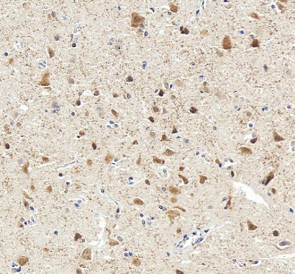 IHC analysis of NeuN/RBFOX3 using anti-NeuN/RBFOX3 antibody (A11954-1)