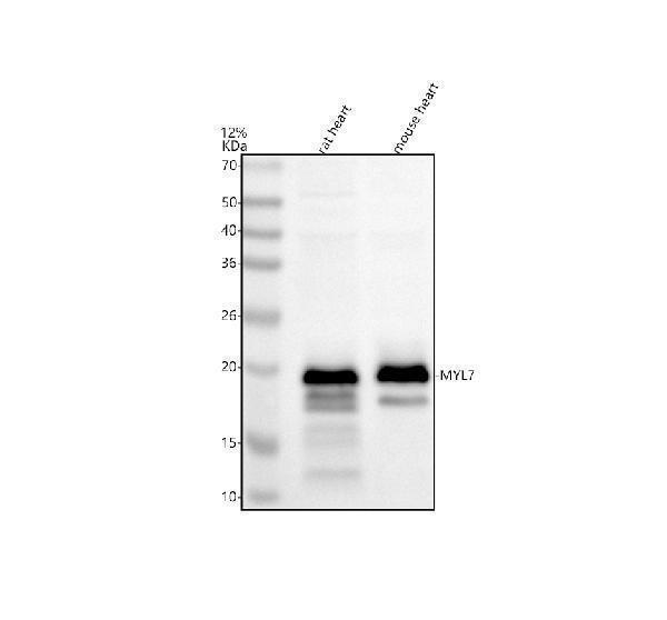 a11956 1 myl7 primary antibodies wb testing 1