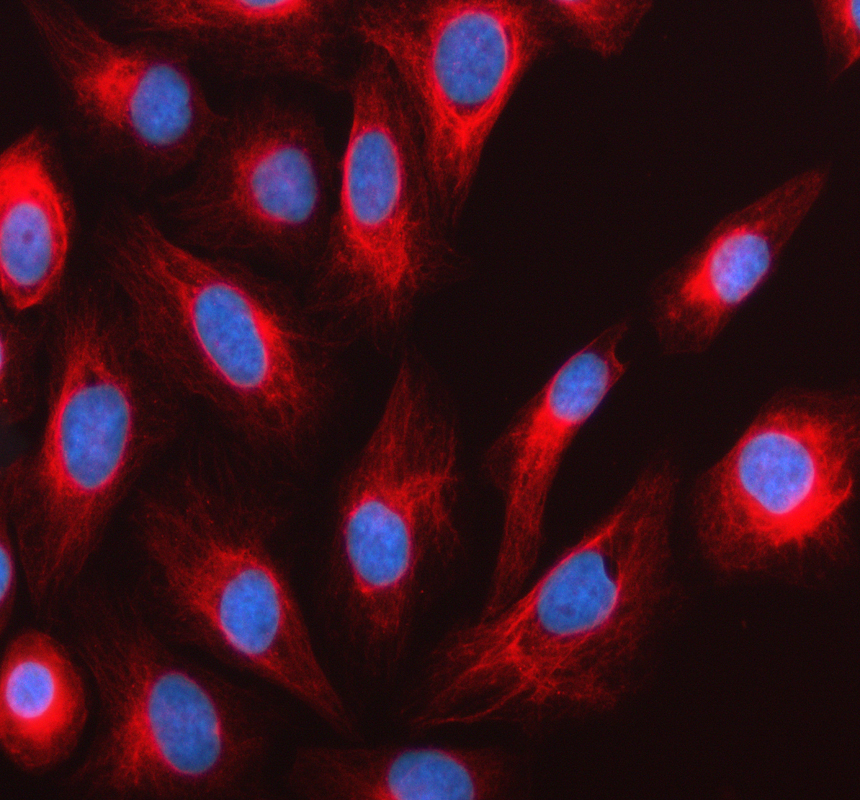 a11958 lrr1 primary antibodies if testing 1