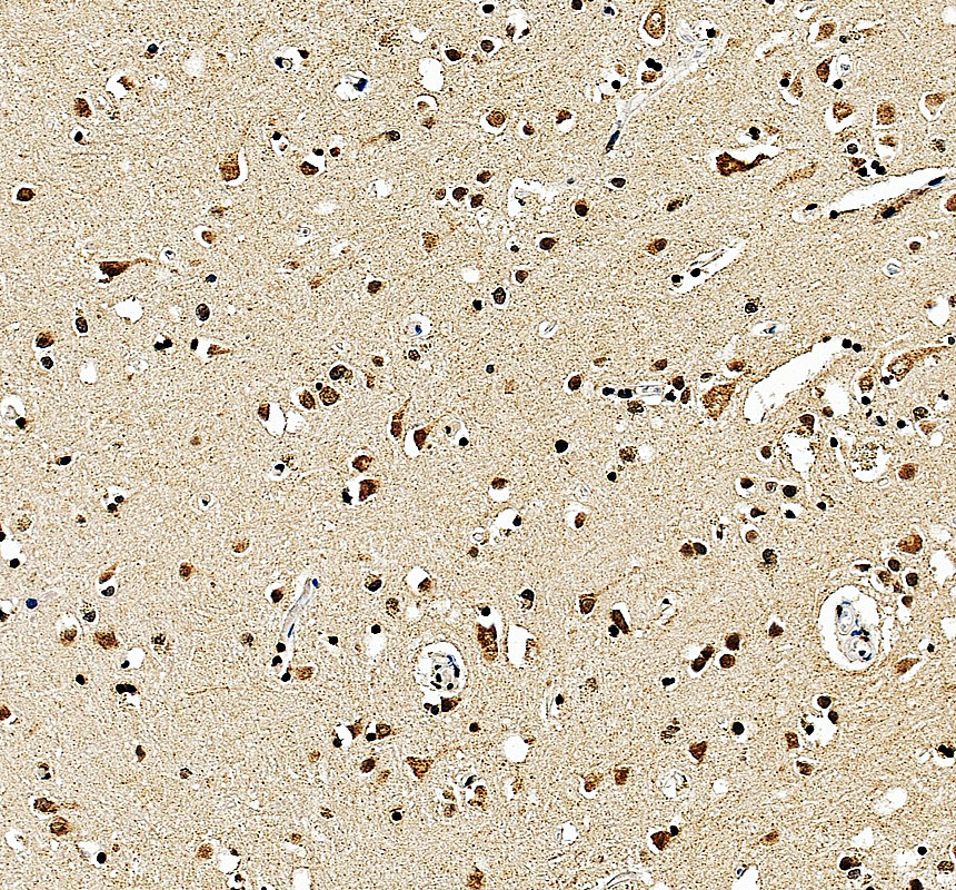 a11958 lrr1 primary antibodies ihc testing 1