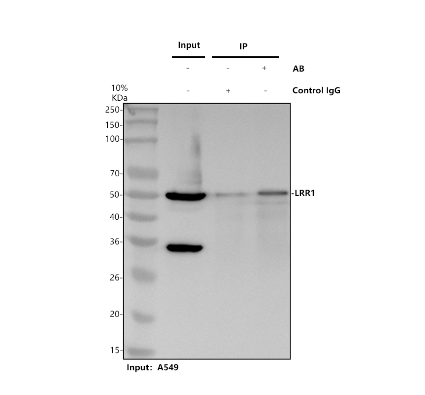 a11958 lrr1 primary antibodies ip testing 1