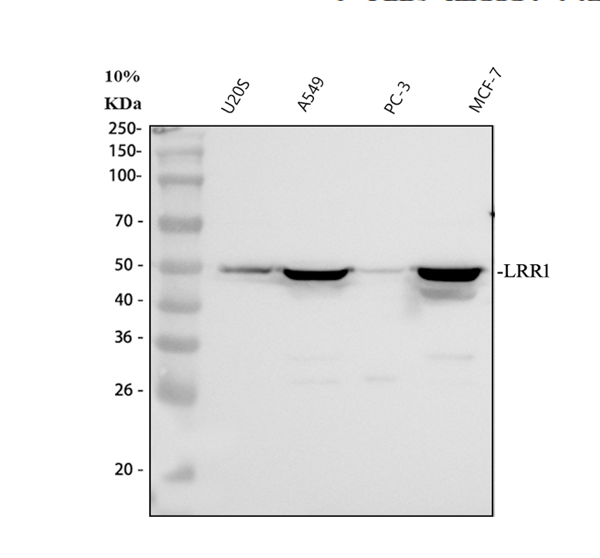a11958 lrr1 primary antibodies wb testing 1