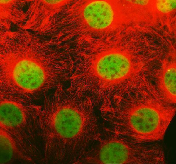 IF analysis of PRR3 using anti-PRR3 antibody (A11961) and anti-Alpha Tubulin antibody (M03989-3)