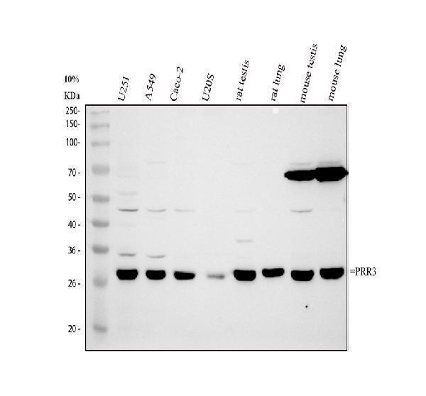 Western blot analysis of PRR3 using anti-PRR3 antibody (A11961)