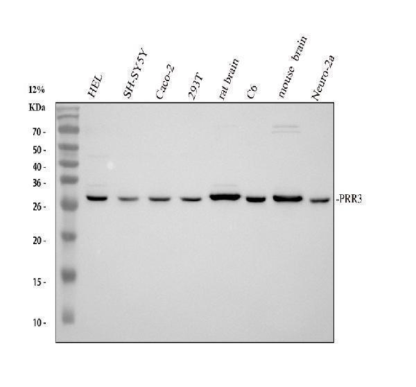 Western blot analysis of PRR3 using anti-PRR3 antibody (A11961)