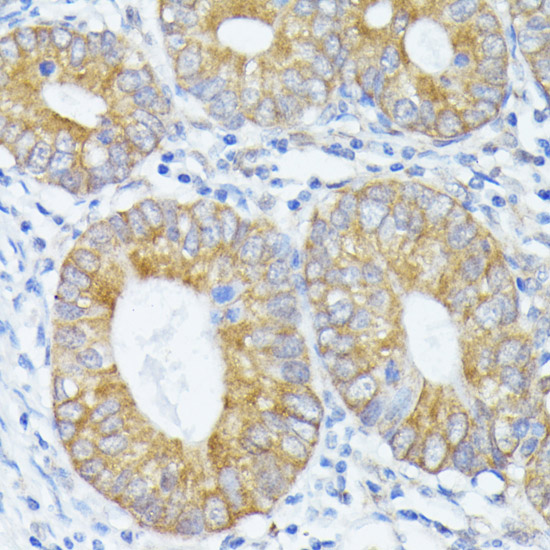a11965 pfdn4 primary antiboties if testing 4